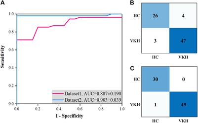 Classification of Vogt-Koyanagi-Harada disease using feature selection and classification based on wide-field swept-source optical coherence tomography angiography